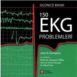 150 EKG Problemleri - 1