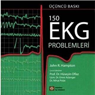 150 EKG Problemleri - 1