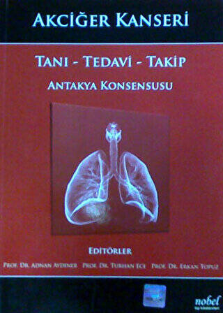Akciğer Kanseri: Tanı - Tedavi - Takip - Antakya Konsensusu - 1