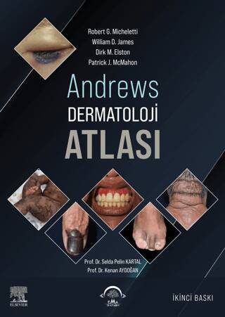 Andrews Dermatoloji Atlası - 1