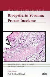 Biyopsilerin Yorumu: Frozen İnceleme - 1