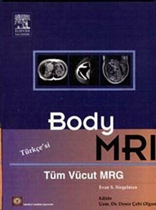 Body MRI Türkçe Çeviri - 1