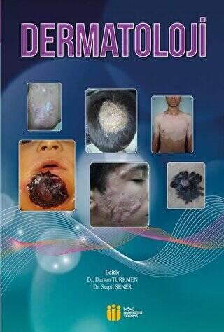 Dermatoloji - 1