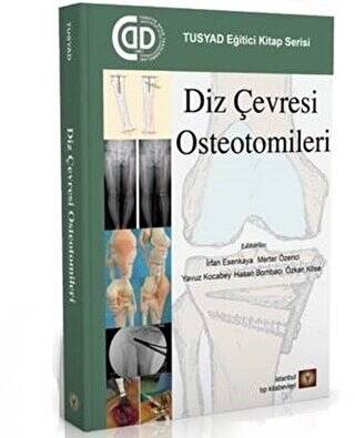 Diz Çevresi Osteotomileri - 1