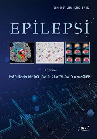 Epilepsi - 1