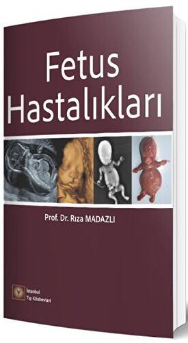 Fetus Hastalıkları - 1