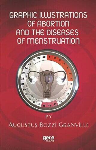 Graphic Illustrations Of Abortion And The Diseases Of Menstruation - 1