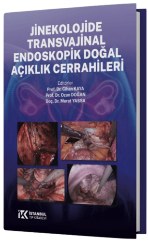 Jinekolojide Transvajinal Endoskopik Doğal Açıklık Cerrahileri - 1