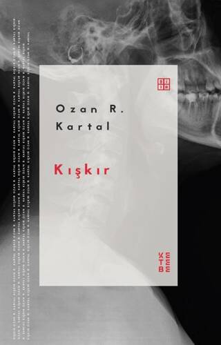 Kışkır - 1