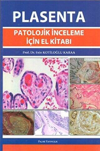 Plasenta Patolojik İnceleme İçin El Kitabı - 1