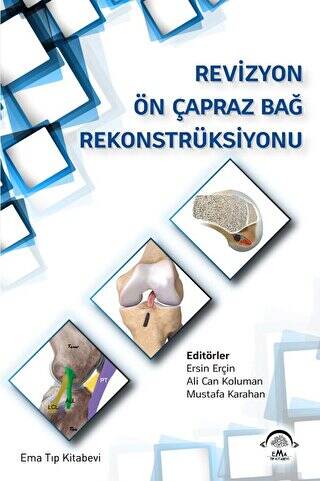 Revizyon Ön Çapraz Bağ Rekonstrüksiyonu - 1