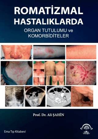 Romatizmal Hastalıklarda Organ Tutulumu ve Komorbiditeler - 1