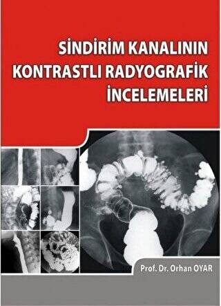 Sindirim Kanalının Kontrastlı Radyografik İncelemeleri - 1
