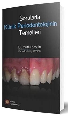 Sorularla Klinik Periodontolojinin Temelleri - 1