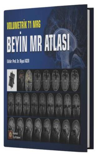 Volumetrik T1 MRG Beyin MR Atlası - 1